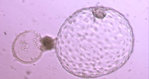 Fully hatched blastocyst 6ΑΑ